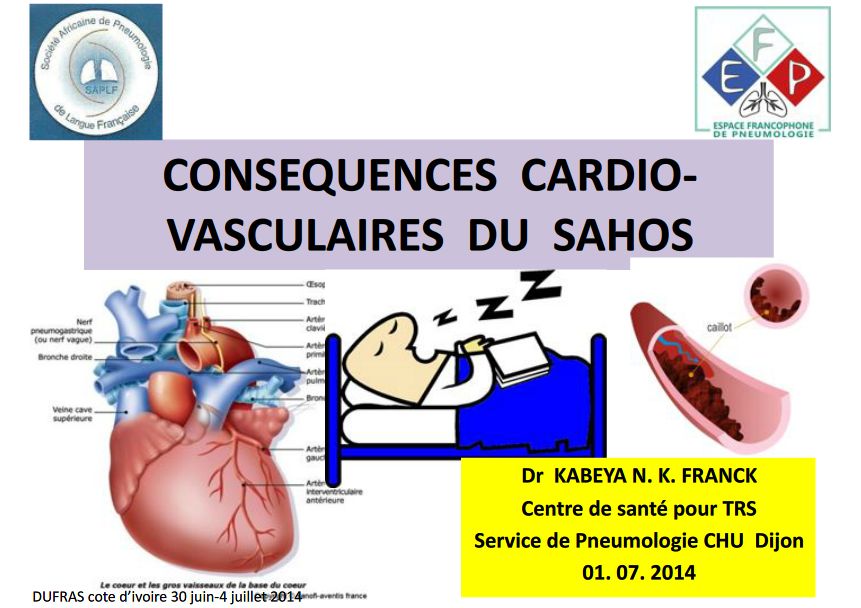Conséquences cardio-vasculaires du SAHOS. Dr KABEYA