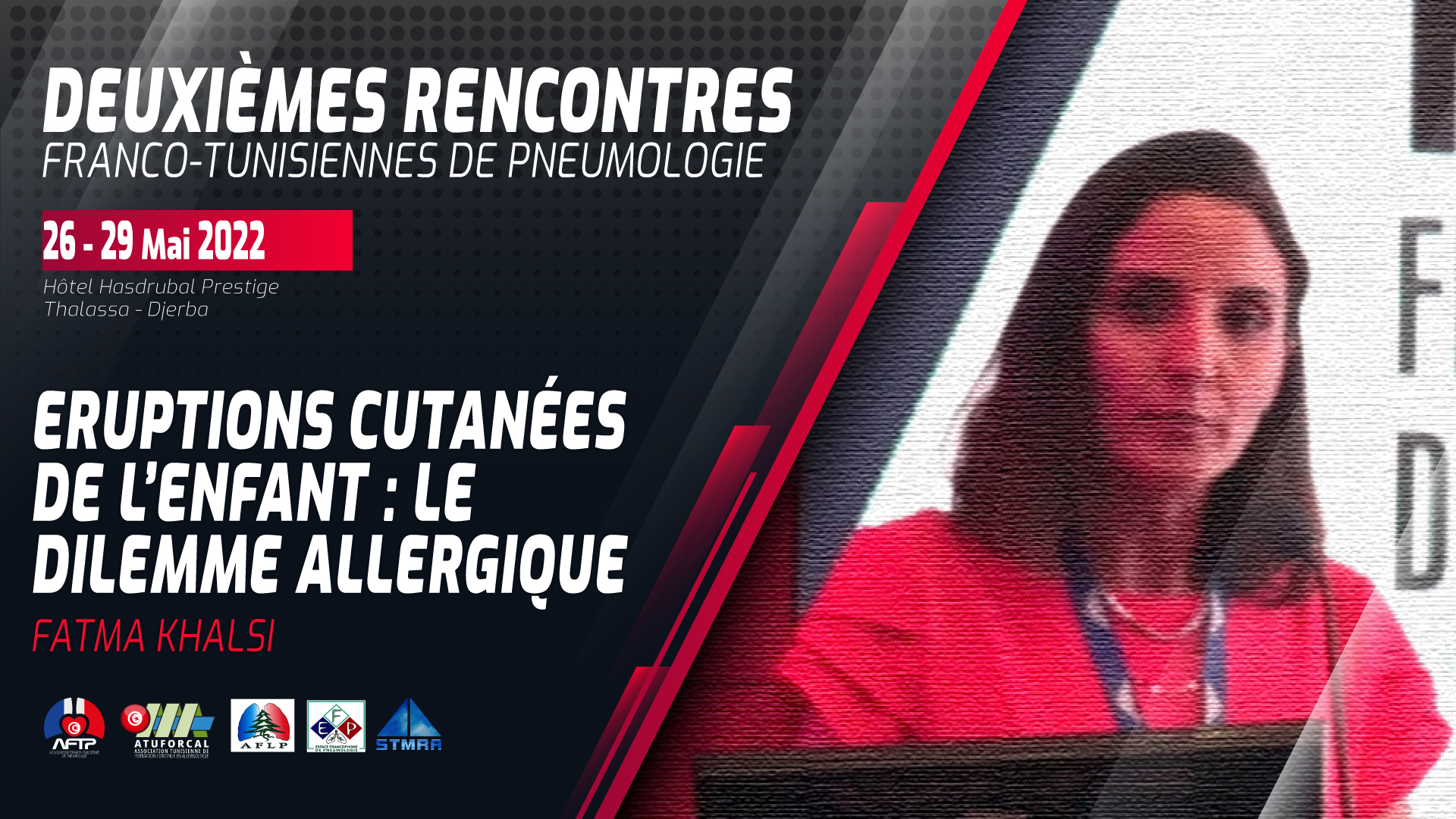 Eruptions cutanées de l’enfant le dilemme allergique. Fatma Khalsi