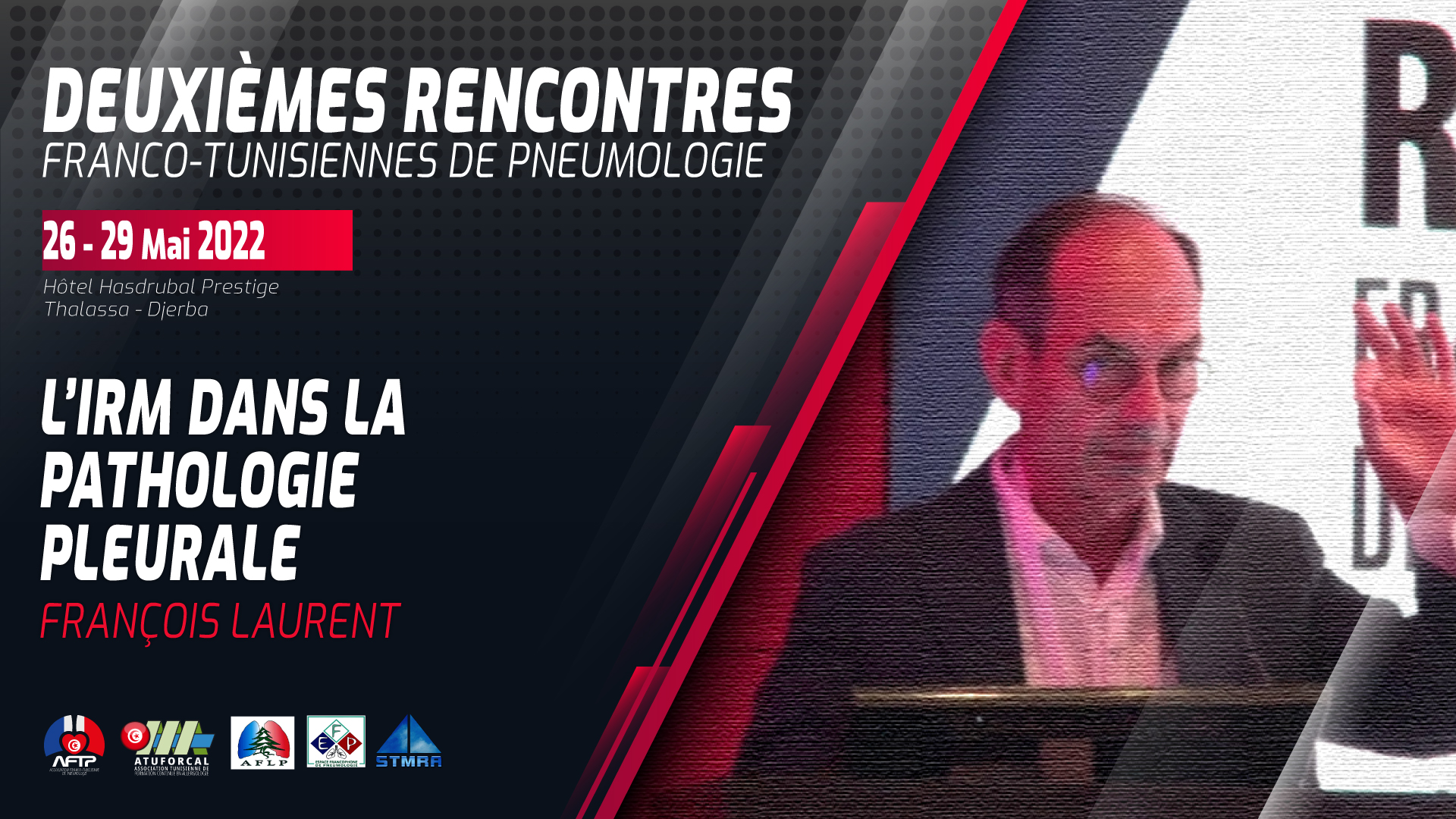 Imagerie de la plèvre : IRM? Scanner? Intelligence artificielle? François Laurent