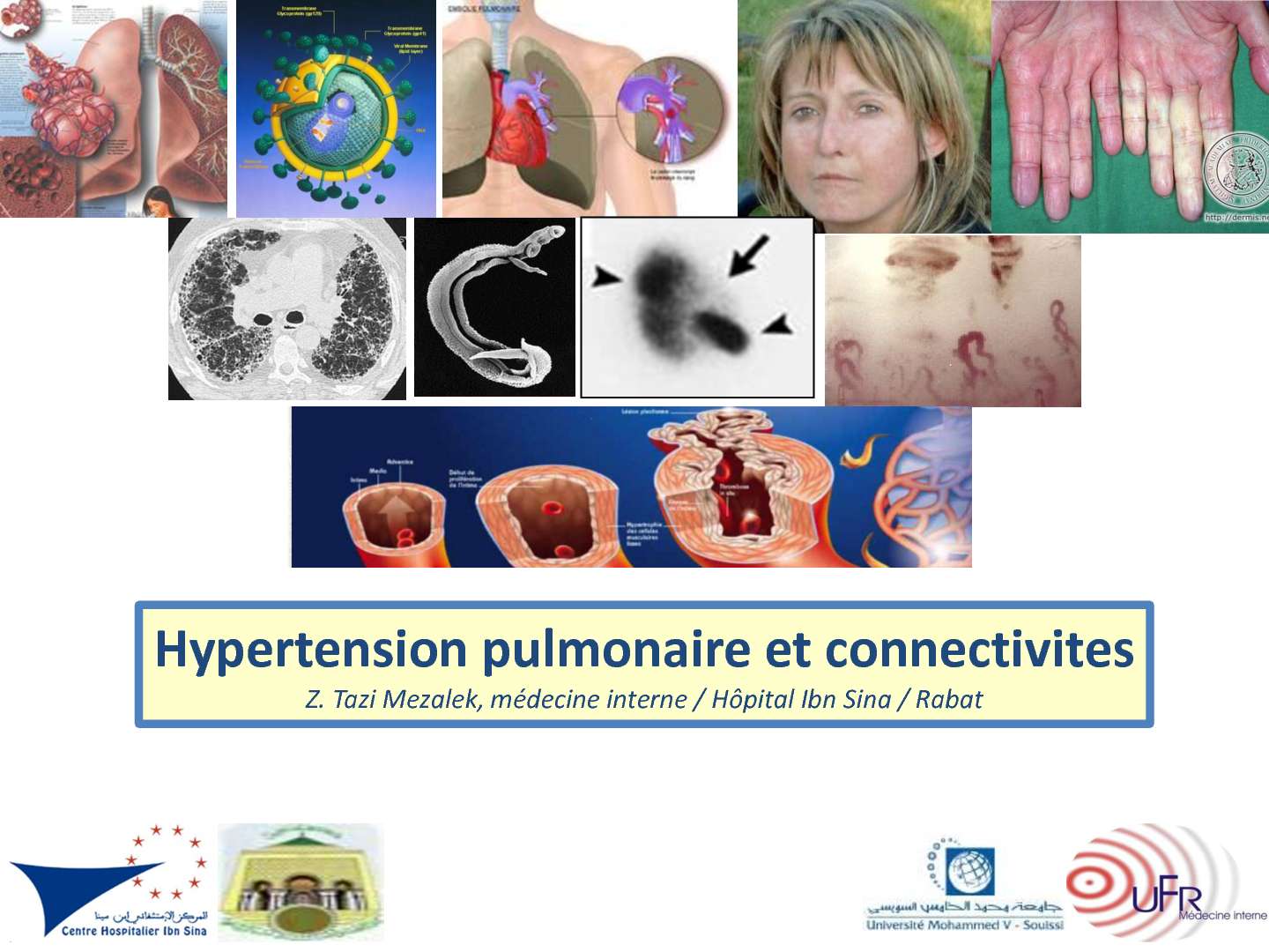 HTAP des Connectivites. Z. TAZI MEZAlEK (Rabat)