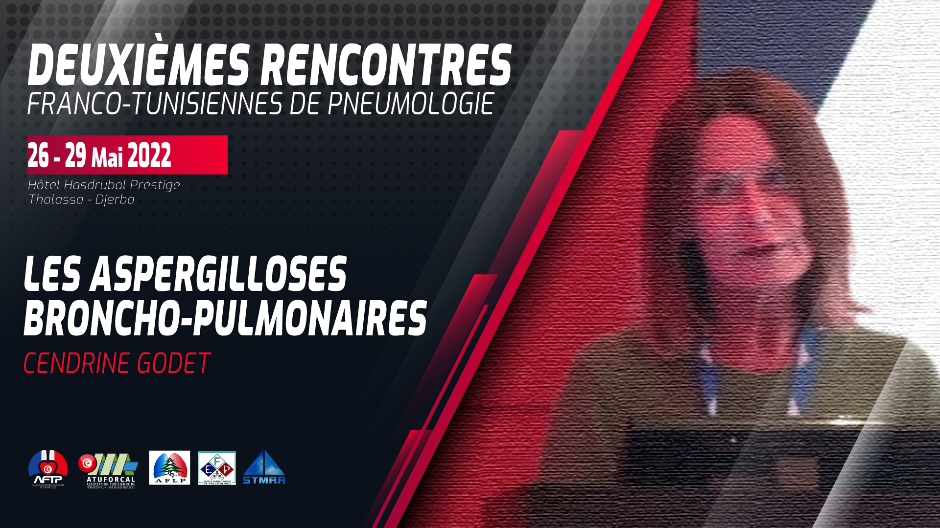 Les Aspergilloses broncho pulmonaires. Cendrine Godet