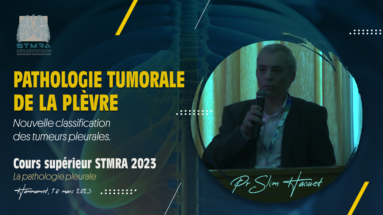 Pathologie tumorale : Nouvelle classification des tumeurs pleurales