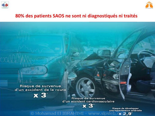Moyens diagnostiques simples du SAS, hors laboratoire. Mohamed El Ibrahimi