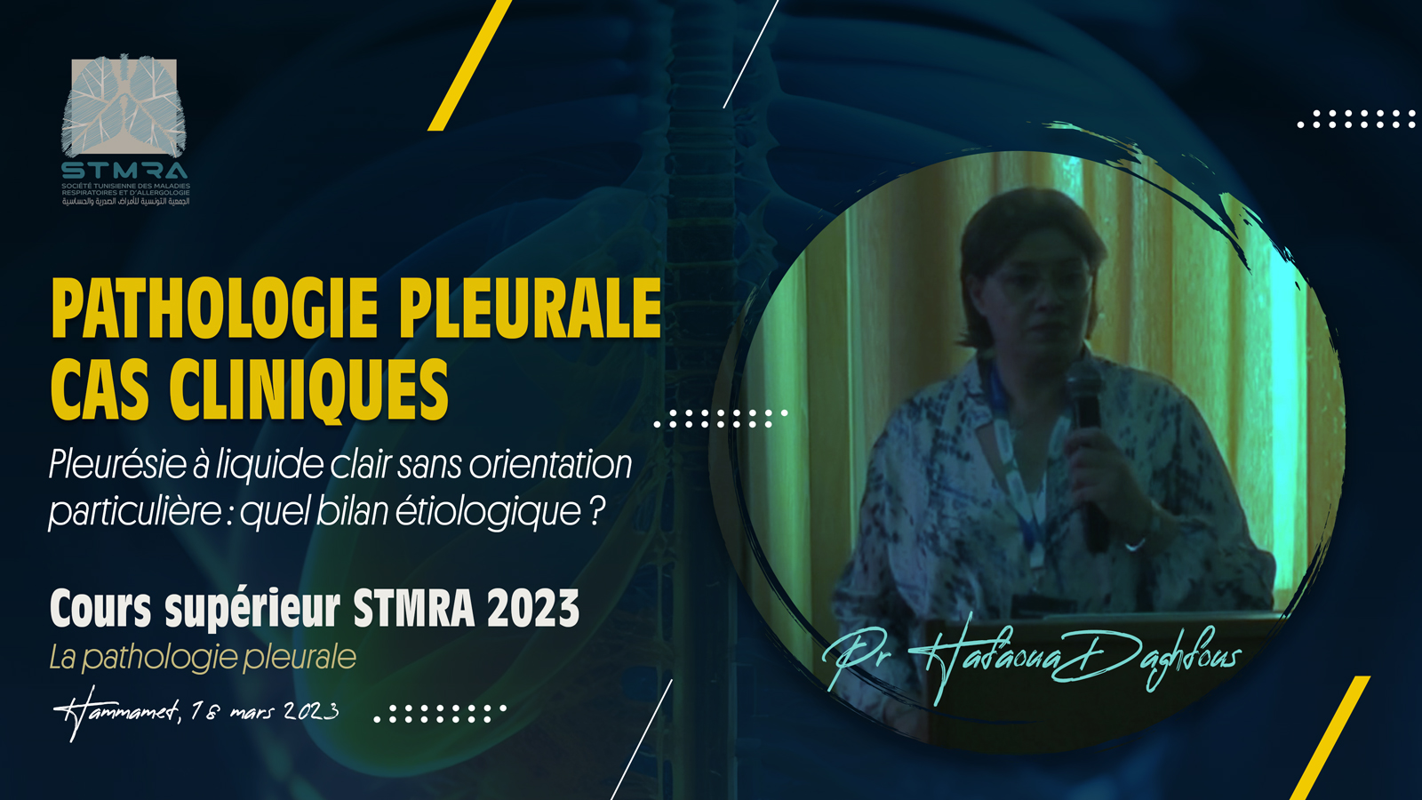 Cas clinique : Pleurésie à liquide clair sans orientation particulière : Quel bilan étiologique ?